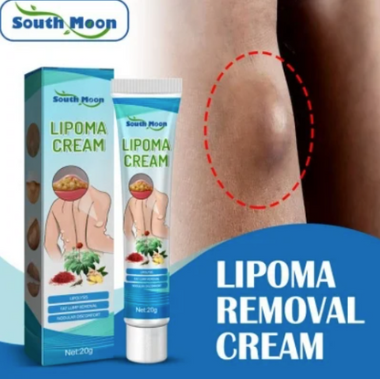 Lipoma Removal Cream