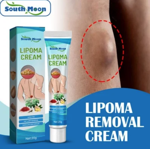 Lipoma Removal Cream
